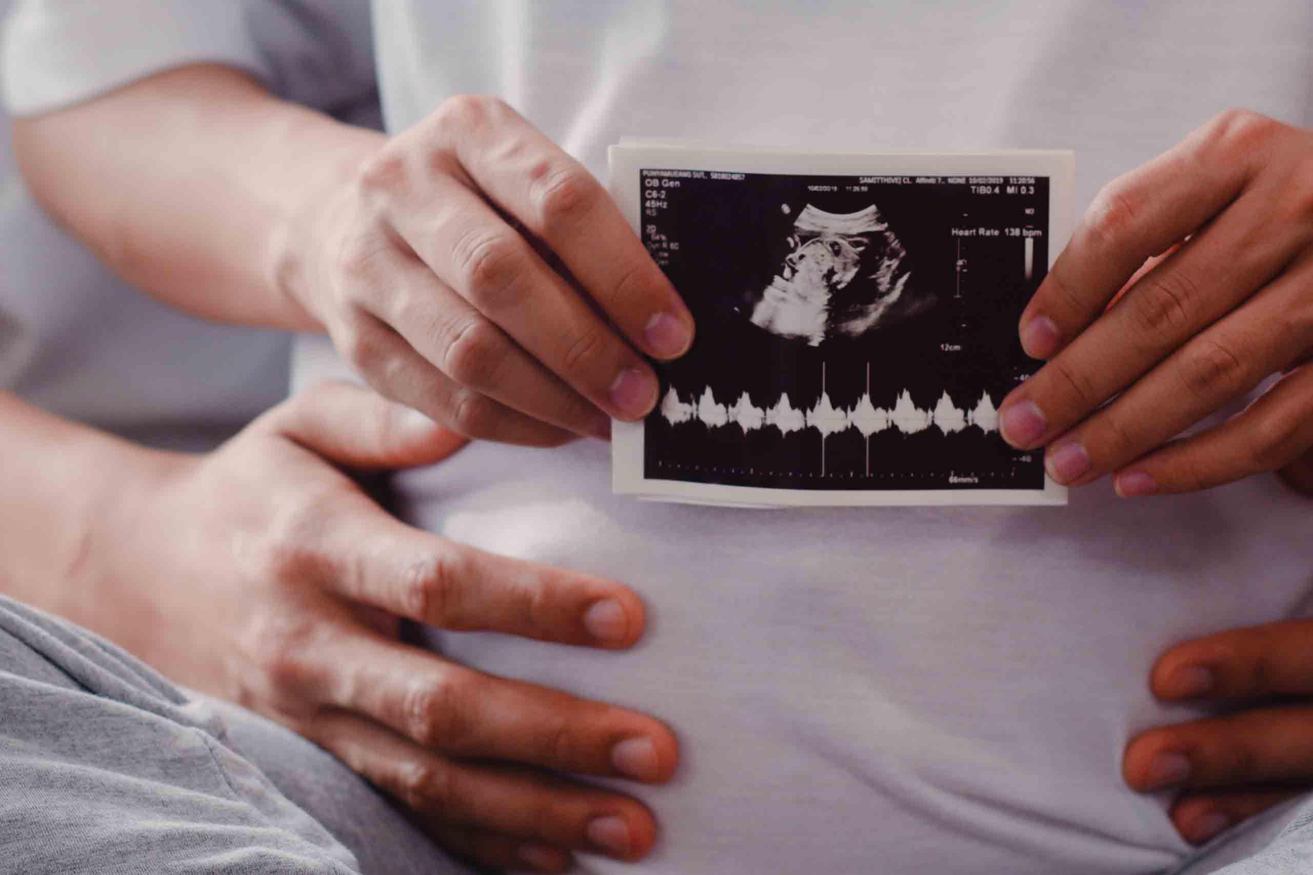 MINI IVF എന്ന ചികിത്സാ 35 രീതിയെ കുറിച്ച് വിശദീകരിക്കാമോ?