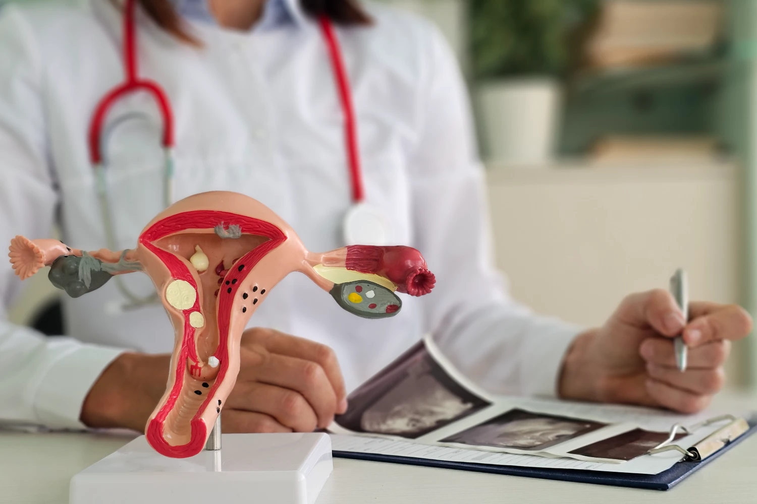 എന്താണ് എംപ്റ്റി ഫോളിക്കിൾ സിൻഡ്രോം?